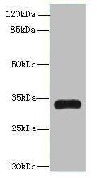 TMEM177 antibody