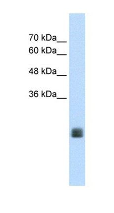 TMEM178A antibody