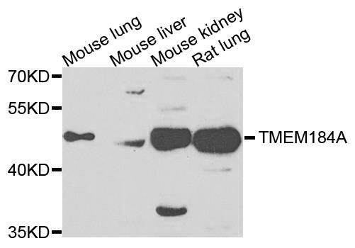 TMEM184A antibody