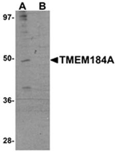 TMEM184A Antibody