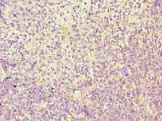 TMEM184C Antibody