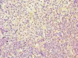 TMEM184C antibody