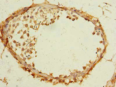 TMEM186 Antibody