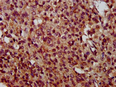 TMEM192 Antibody