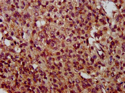 TMEM192 antibody