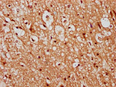 TMEM2 Antibody