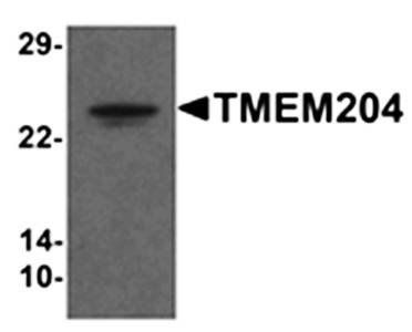 TMEM204 Antibody