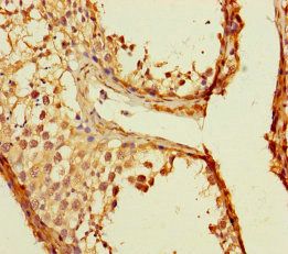 TMEM213 Antibody