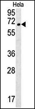 TMEM214 antibody
