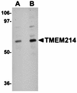 TMEM214 Antibody