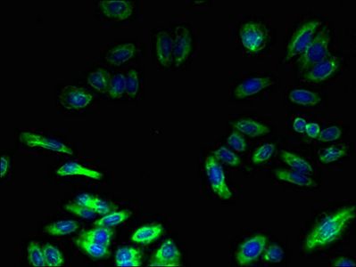 TMEM217 antibody