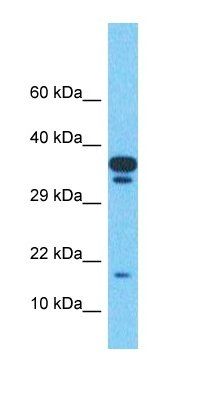 TMEM220 antibody