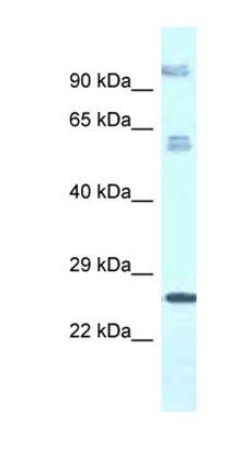 TMEM222 antibody