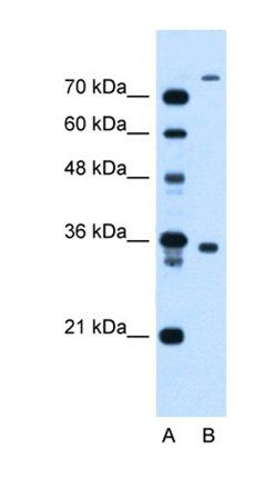 TMEM231 antibody