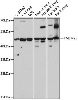 TMEM25 antibody