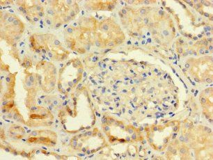 TMEM255B Antibody