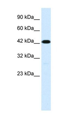 TMEM259 antibody