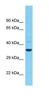 TMEM26 antibody