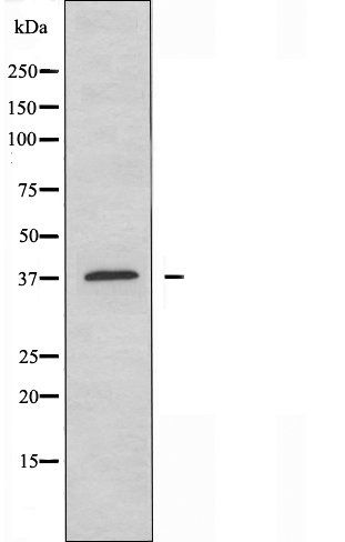 TMEM30B antibody