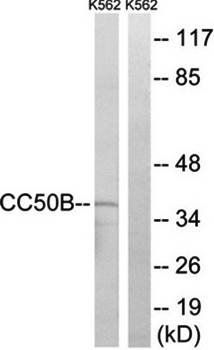 TMEM30B Antibody