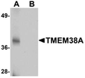 TMEM38A Antibody