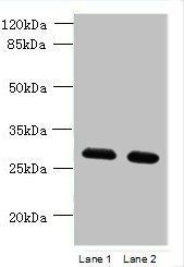 TMEM38B antibody