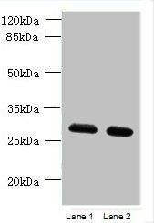 TMEM38B Antibody