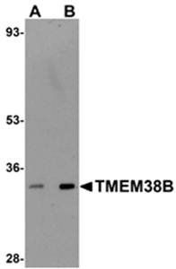 TMEM38B Antibody