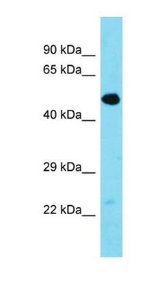 Tmem39a antibody