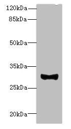 TMEM41A Antibody