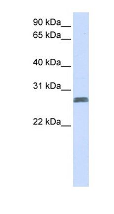 TMEM51 antibody