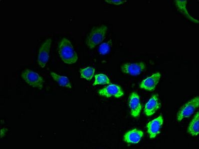 TMEM53 Antibody