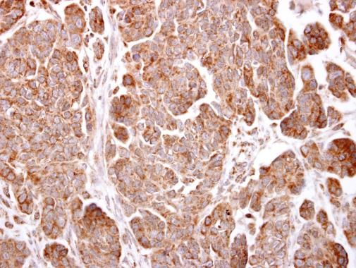 TMEM59 Rabbit Polyclonal Antibody