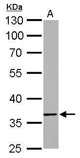 TMEM59 Rabbit Polyclonal Antibody