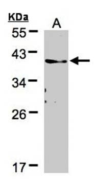 thymic dendritic cell-derived factor 1 precursor antibody