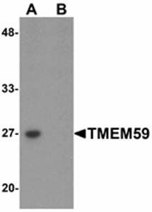 TMEM59 Antibody