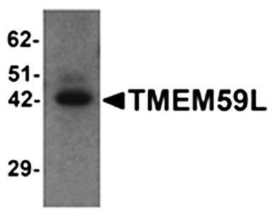 TMEM59L Antibody