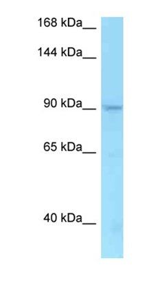 TMEM63A antibody