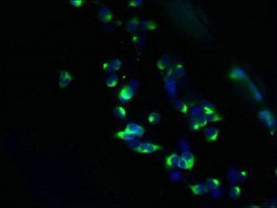 TMEM63A Antibody