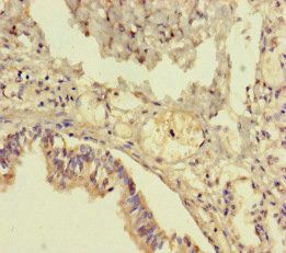 TMEM64 Antibody