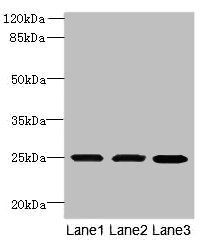 TMEM65 antibody