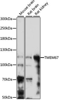 TMEM67 antibody