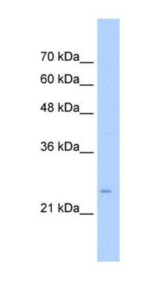 TMEM69 antibody