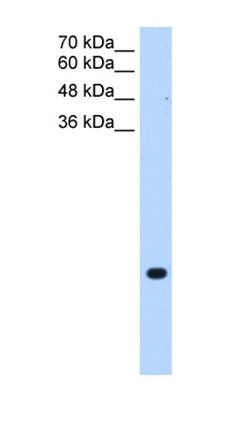 TMEM75 antibody
