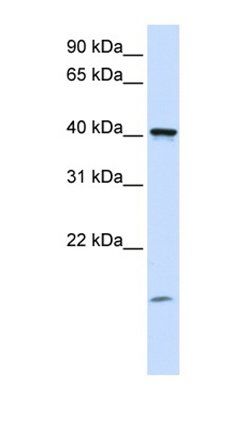 TMEM79 antibody