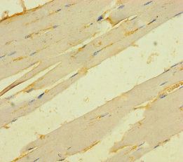 TMEM82 Antibody