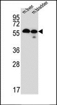 TMEM87B antibody