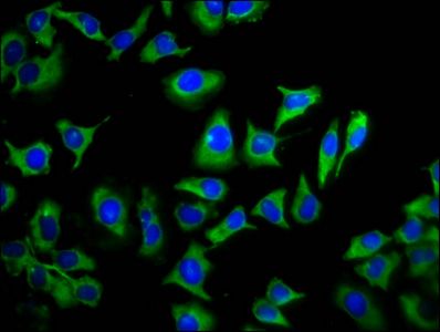 TMEM88 Antibody