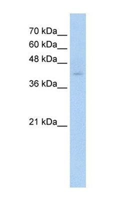 TMEM8B antibody