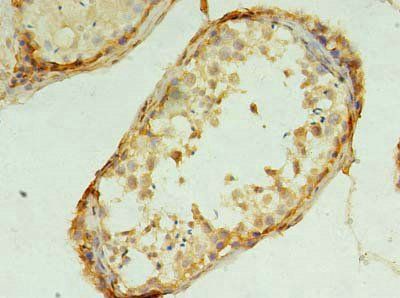 TMEM9 antibody